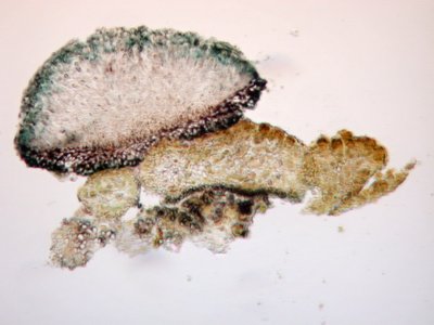[Placynthium sp. nov.]